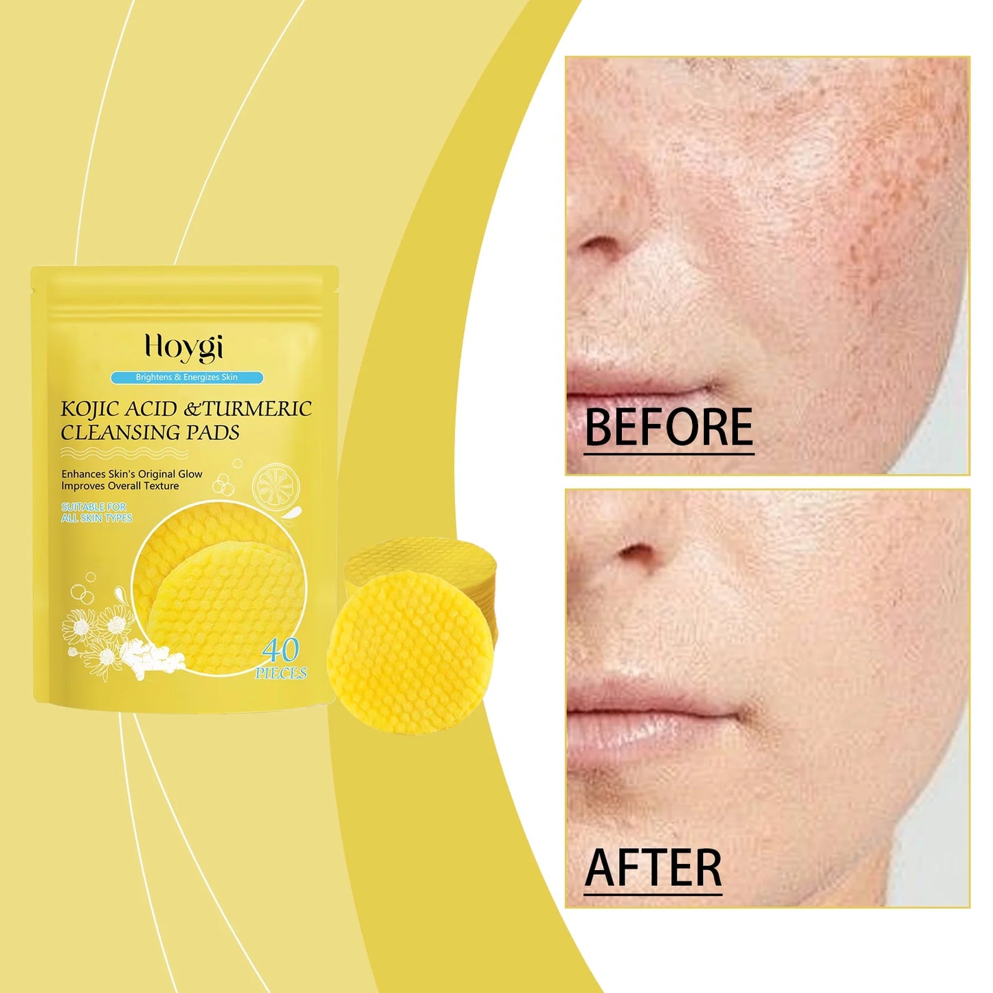 Turmeric Cleansing Pads,Kojic Acid and Turmeric Cleansing Pads for Face and Body Remove Excess Keratin