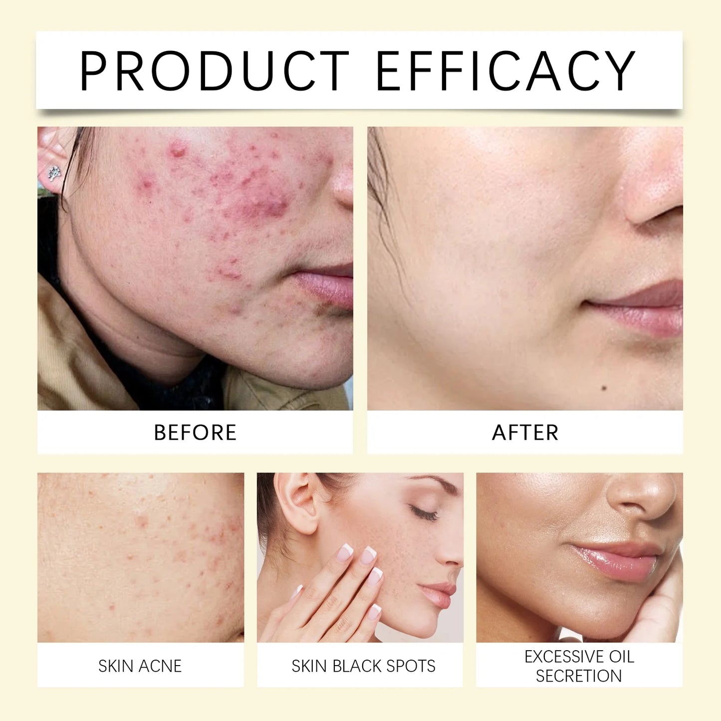 Turmeric Cleansing Pads,Kojic Acid and Turmeric Cleansing Pads for Face and Body Remove Excess Keratin